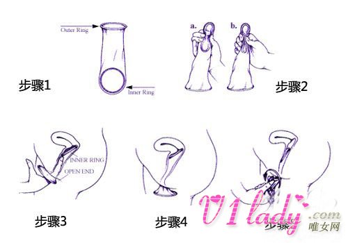 女用避孕套怎么用?