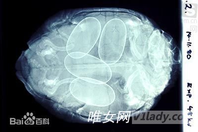 冷冻卵子是什么?冷冻卵子是怎么回事?